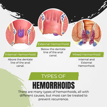 Load image into Gallery viewer, No.1 Hemorrhoids Treatment Spray