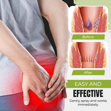 Load image into Gallery viewer, No.1 Hemorrhoids Treatment Spray