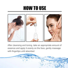 Load image into Gallery viewer, 🔥Last Day Promotion 70% OFF-Niacinamide Facial Essence💖