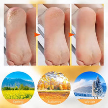 Load image into Gallery viewer, 🔥2023 New Sale🔥-Moisturizing Foot Mask Exfoliating Silicone Socks Beach Protective Socks