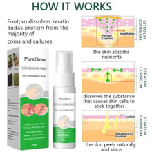 Load image into Gallery viewer, PureGlow™ Corn Remover Power Spray (New P)