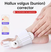 Load image into Gallery viewer, Orthopedic Bunion Corrector &amp; Bunion Relief Splint