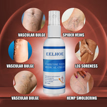 Load image into Gallery viewer, Vein Treatment Varicose Vein Treatment Spray, Leg Varicose Vein Treatment