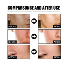 Load image into Gallery viewer, 🔥Last Day Promotion 70% OFF-Niacinamide Facial Essence💖