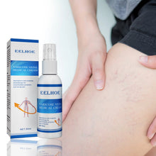 Load image into Gallery viewer, Vein Treatment Varicose Vein Treatment Spray, Leg Varicose Vein Treatment