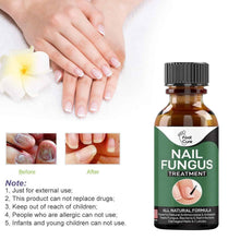 Load image into Gallery viewer, 10ml Oil for Nail Fungus
