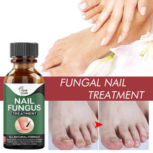 Load image into Gallery viewer, 10ml Oil for Nail Fungus