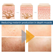 Load image into Gallery viewer, Turmeric Oil For Dark Spot And Wrinkles