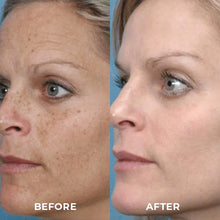 Load image into Gallery viewer, Turmeric Oil For Dark Spot And Wrinkles