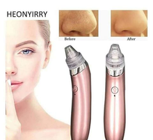 Load image into Gallery viewer, Black Head &amp; Acne Remover Specialist