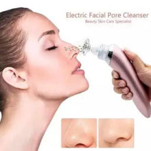 Load image into Gallery viewer, Black Head &amp; Acne Remover Specialist
