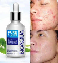 Load image into Gallery viewer, BIO AQUA ACNE REMOVAL CREAM