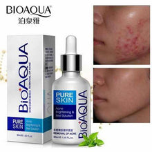 Load image into Gallery viewer, BIO AQUA ACNE REMOVAL CREAM