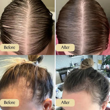 Load image into Gallery viewer, Last day to get over 49% off-Tiworld™-✨Natural Hair Growth Oil