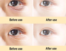 Load image into Gallery viewer, Dr.rashel Anti-Wrinkle Eye Mask for Eye