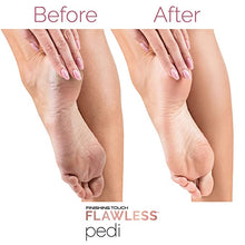 Load image into Gallery viewer, Finishing Touch Flawless Pedi Electronic Tool File and Callus Remover, Pedicure