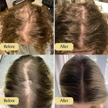 Load image into Gallery viewer, Last day to get over 49% off-Tiworld™-✨Natural Hair Growth Oil