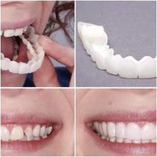 Load image into Gallery viewer, Denture Teeth Temporary Fake Teeth for Snap on Instant &amp; Confidence Smile